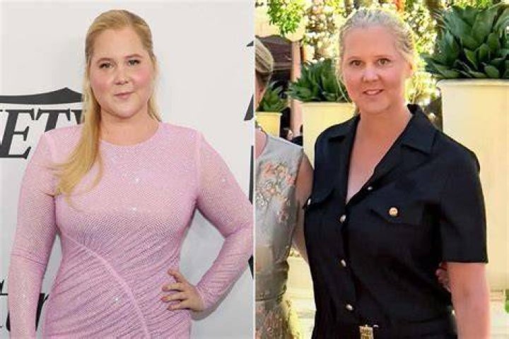 Amy Schneider Weight Loss After Surgery – Before And After Picture And Health Update