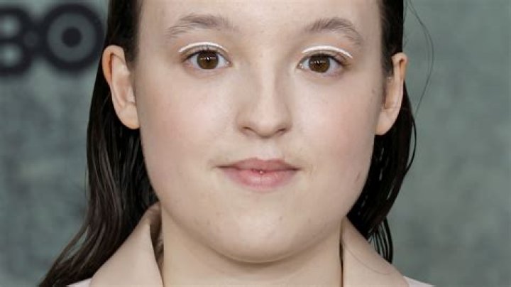 Does Bella Ramsey Have Fetal Alcohol Syndrome? What&rsquo;s Wrong With the