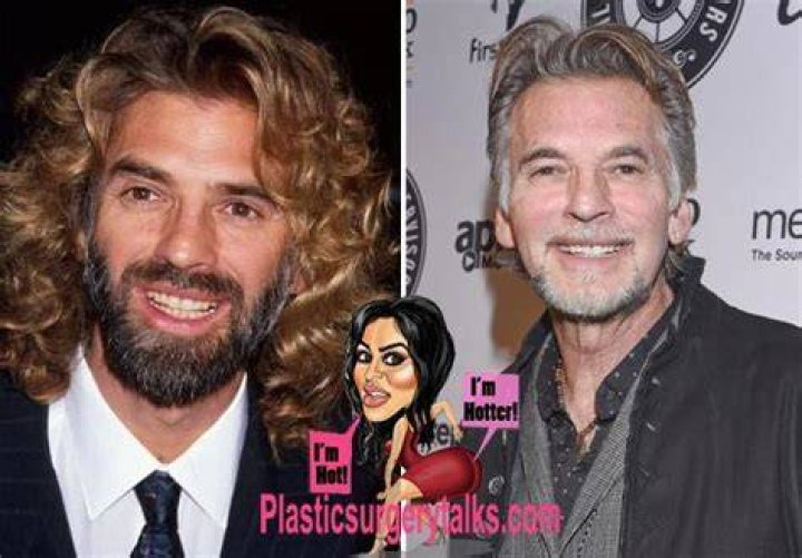 Has Kenny Loggins Had Plastic Surgery? Married Life And His Wives Details ·