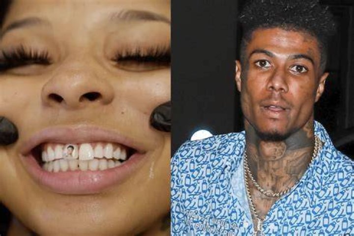HHow Did Chrisean Rock Lose Her Tooth? The Shocking Truth Behind the Rapper’s Missing Smile