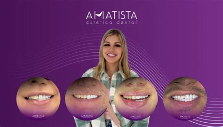 Inicio Amatista Estetica Dental