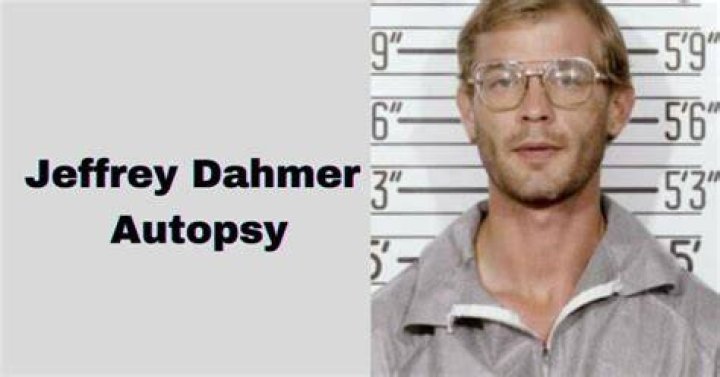 Jeffrey Dahmer Autopsy Photo: Uncovering The Dark Truth