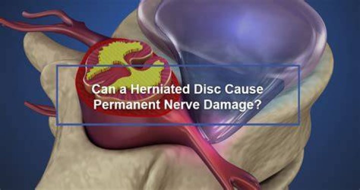 permanent damage